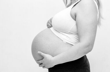 Striae – zwangerschapsstrepen