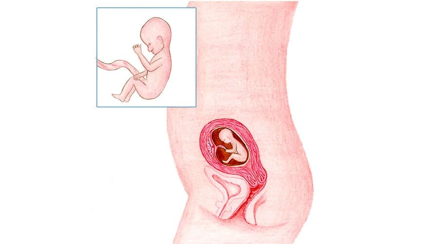 anker Gelijkmatig leerling Zwanger Week 16 - HCG maakt plaats voor progesteron