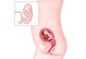Zwanger Week 17: Buikspiertijd maakt plaats voor flostijd