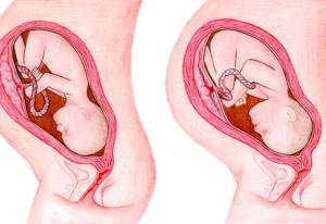 Zwanger week 37, 38, 39, 40, 41: Wachten op de bevalling