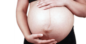 Striae – zwangerschapsstrepen
