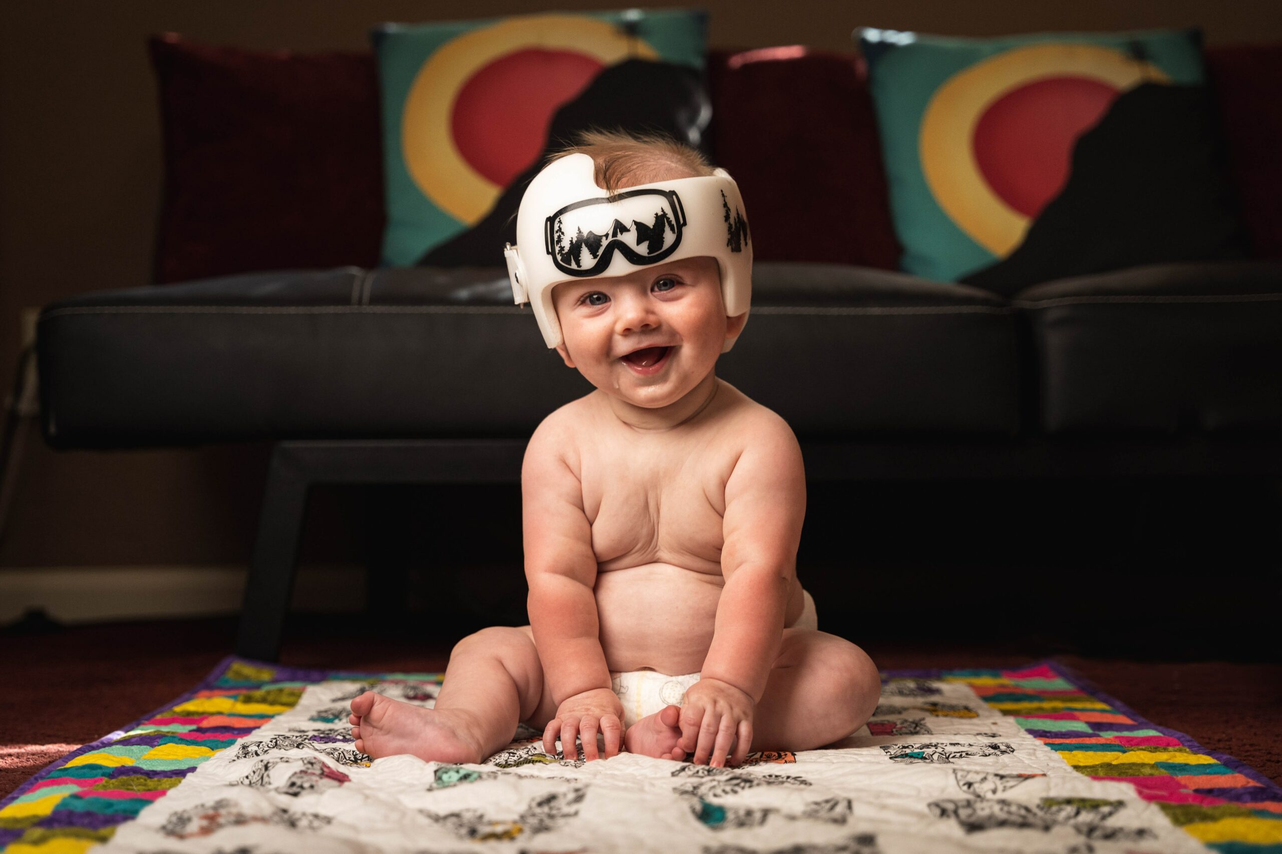 bezoeker vijand code De baby helm als therapie bij een schedelafwijking